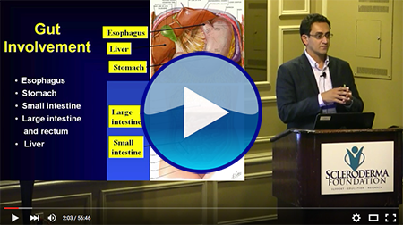 Digestive Issues Video 2015 Conference