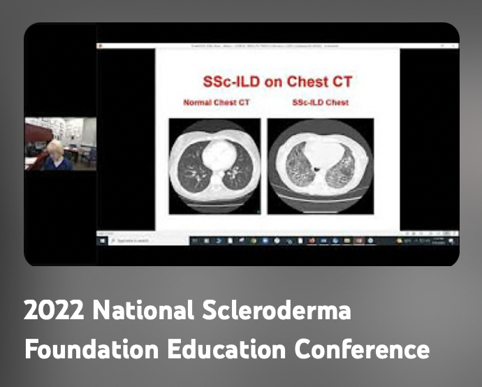 2022 National Scleroderma Conference YouTube